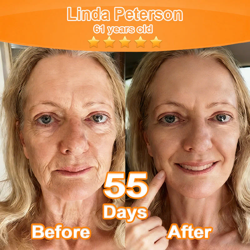 ☘️Purelora® Stem Cell Extract EGF and Copper Peptide Revitalizing Essence Cream (deeply activates the skin's internal regeneration, making the skin firmer and smoother) - Image 8